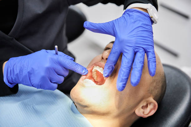 Best Emergency Dental Care for Trauma or Injury in Hayden, CO